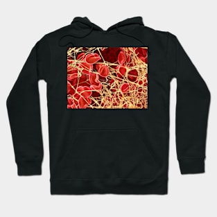 Blood clot, SEM (P260/0107) Hoodie